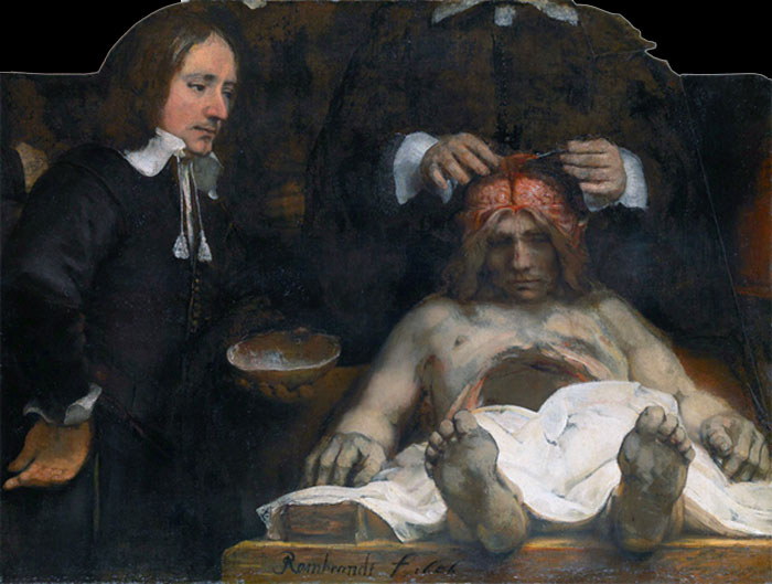 Rembrandt - Anatomy Lesson - Fragment